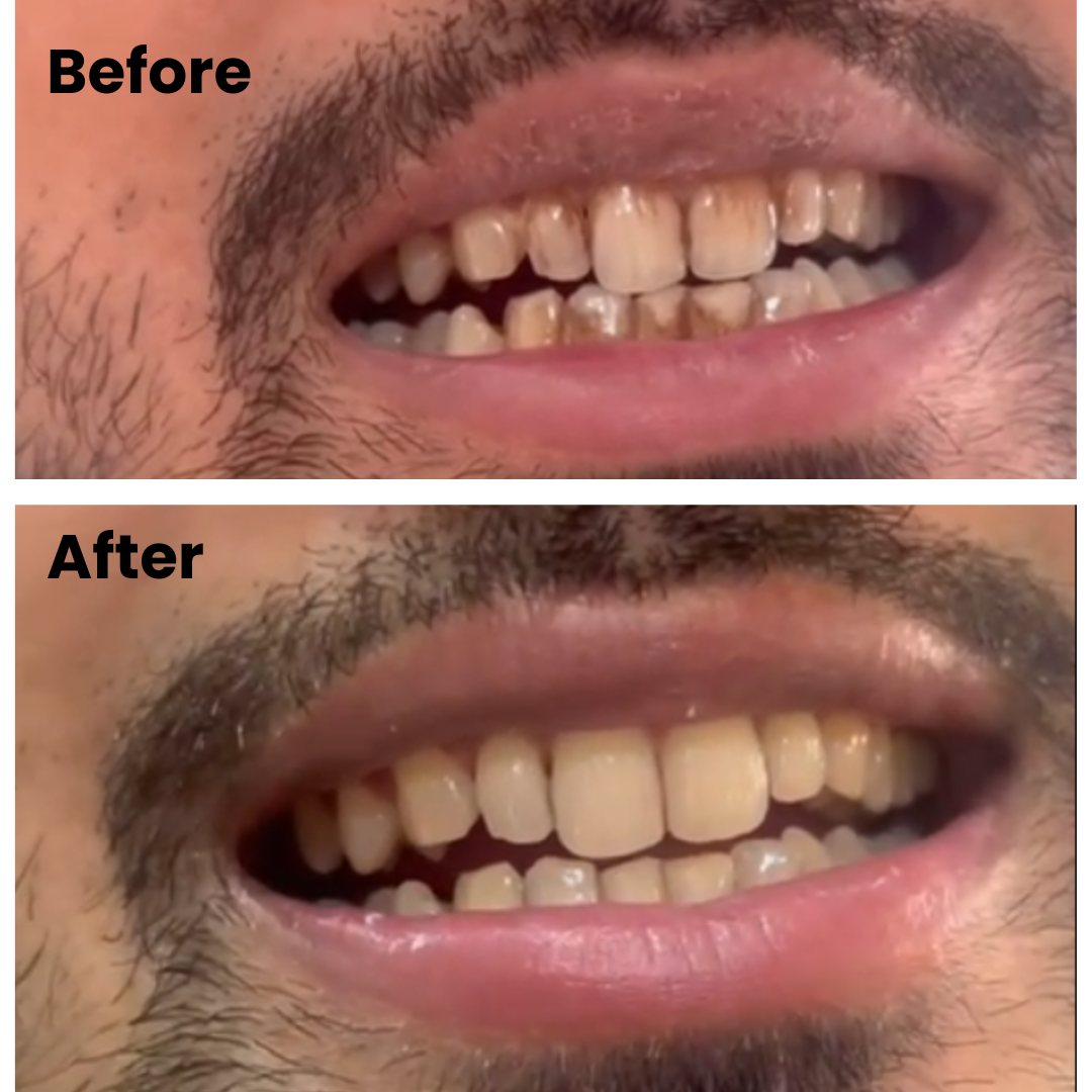 optimus_dental_clinic_Guwahati (1)