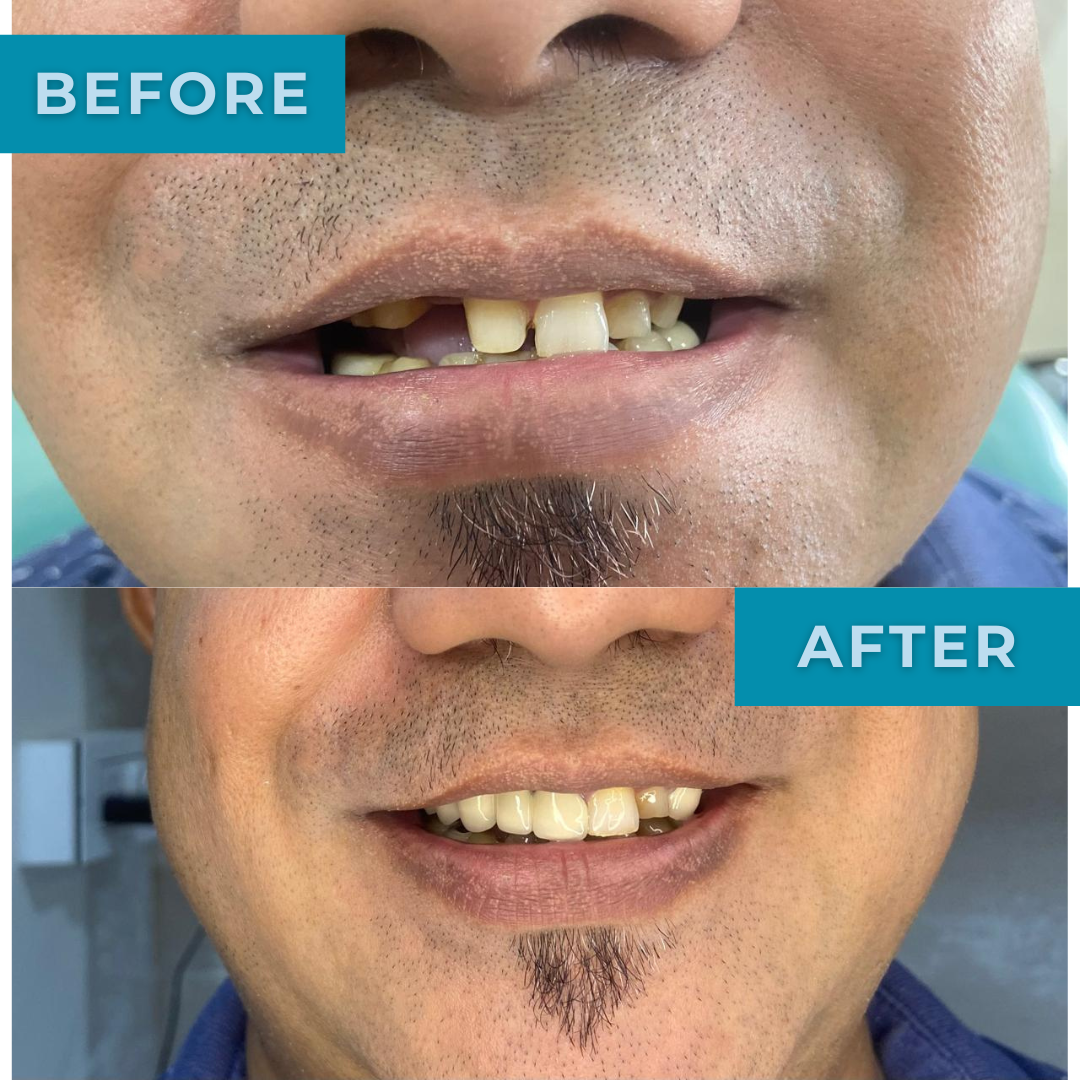 optimus_dental_clinic_Guwahati (4)