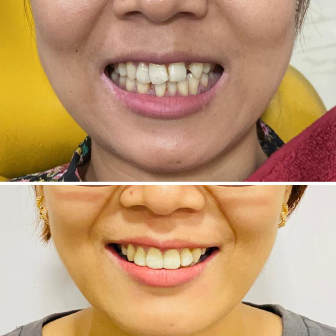 optimus_dental_clinic_Guwahati (6)