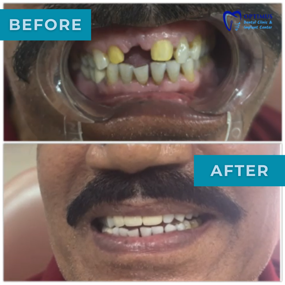 optimus_dental_clinic_Guwahati (1)