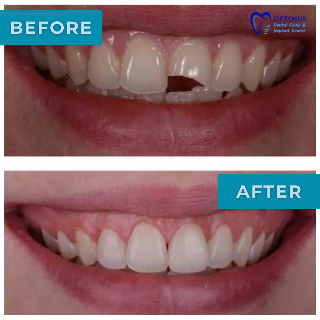 optimus_dental_clinic_Guwahati (10)