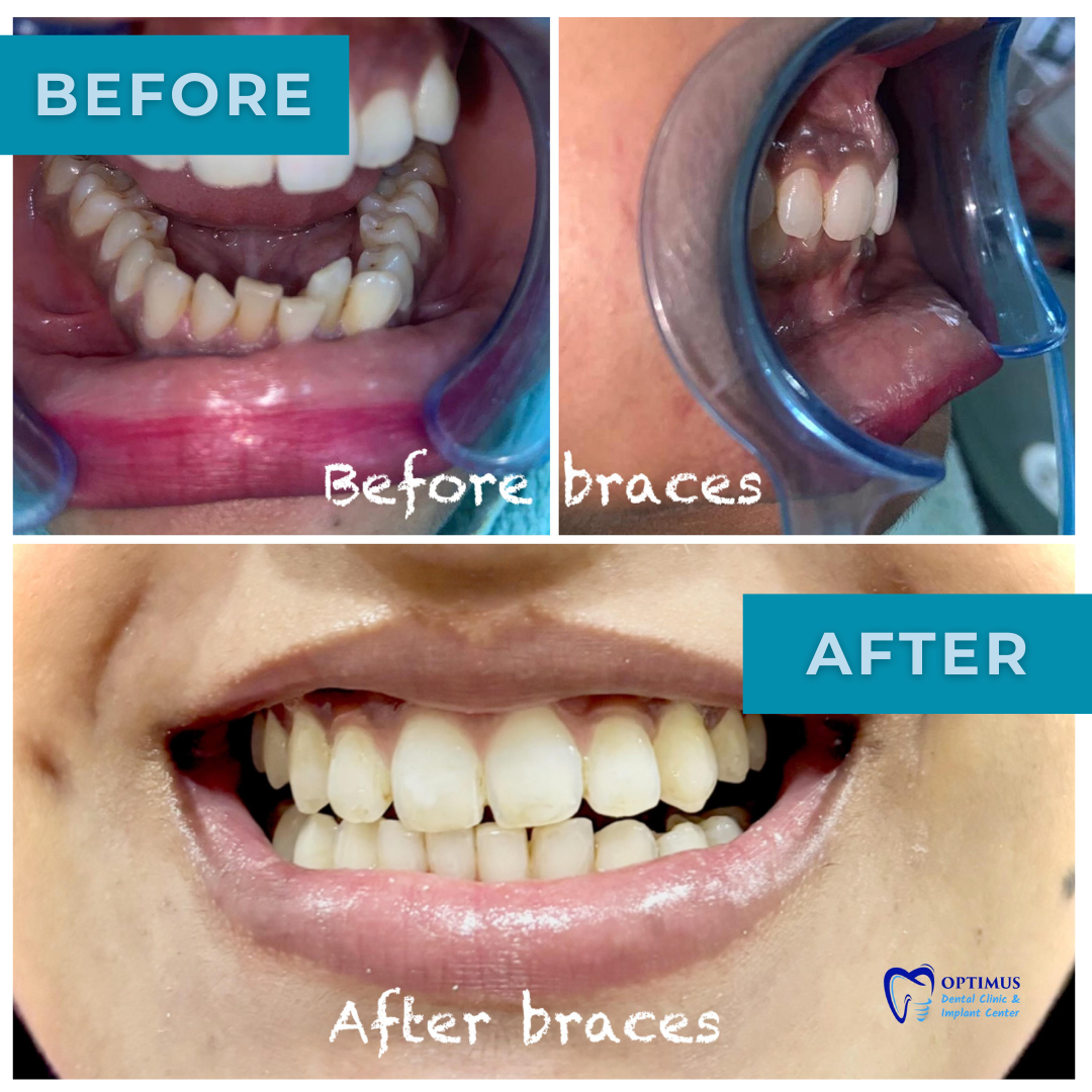 optimus_dental_clinic_Guwahati (12)