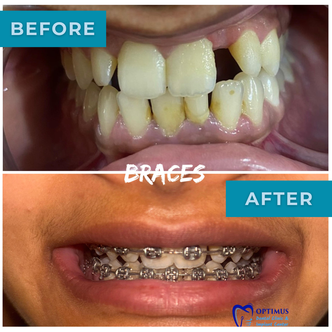 optimus_dental_clinic_Guwahati (13)