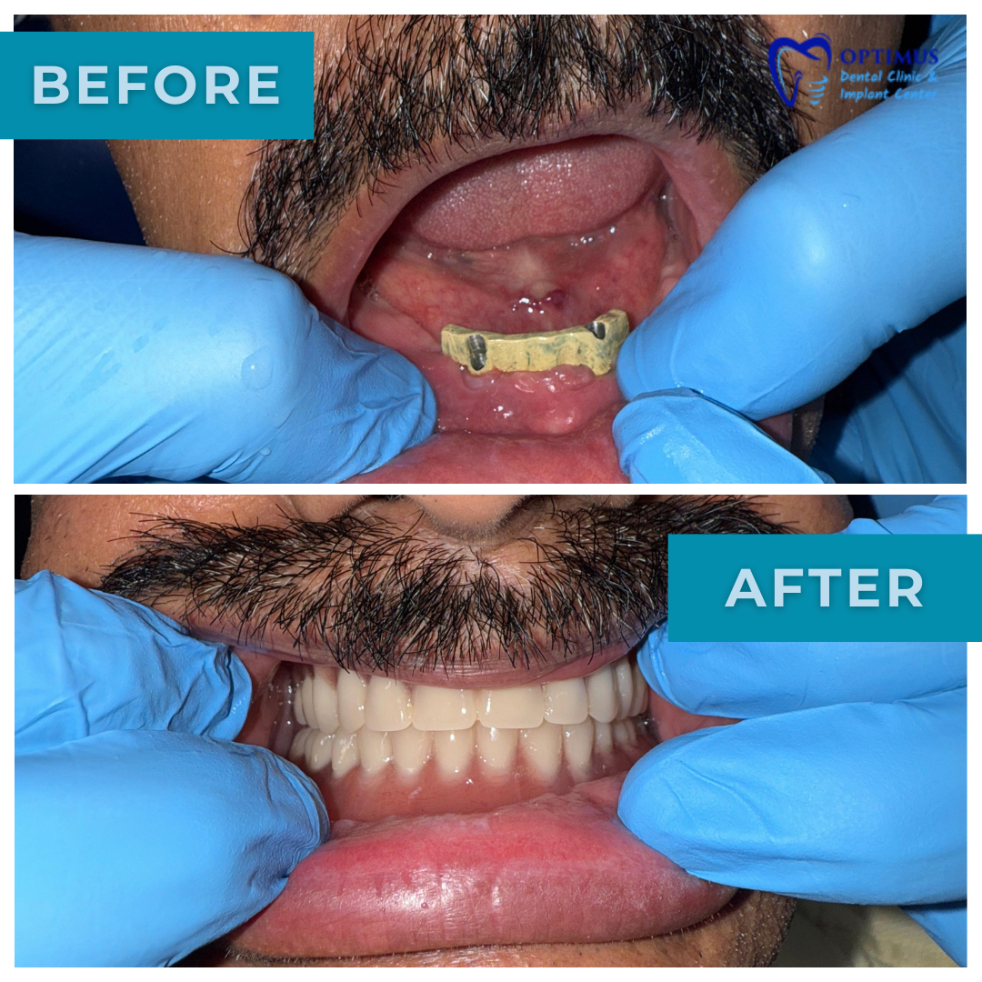 optimus_dental_clinic_Guwahati (4)