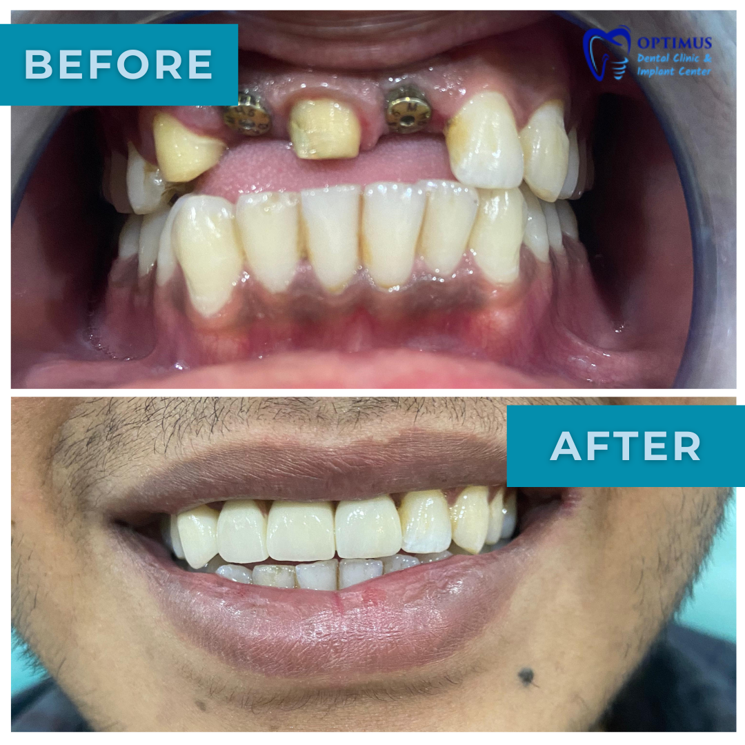optimus_dental_clinic_Guwahati (5)