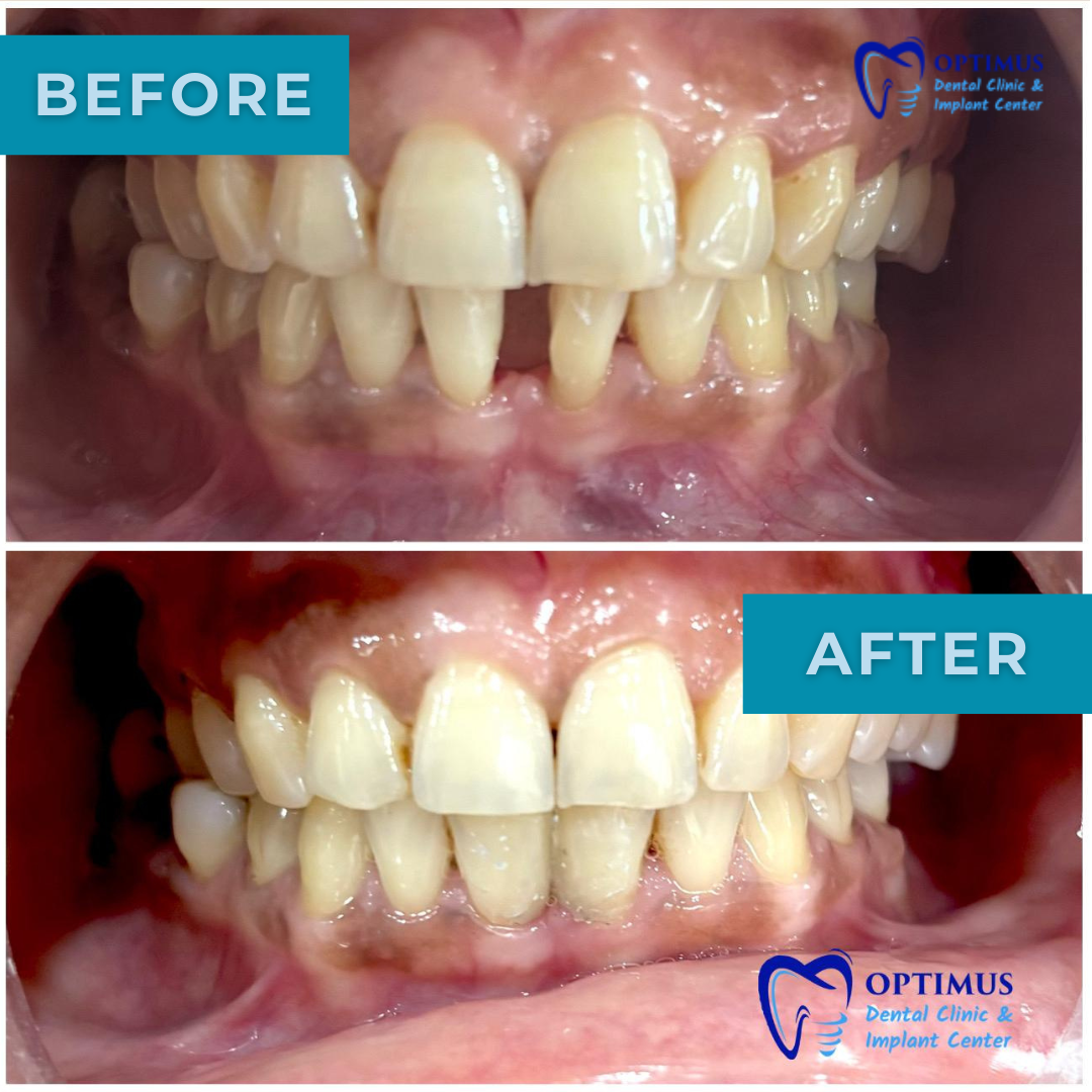 optimus_dental_clinic_Guwahati (6)