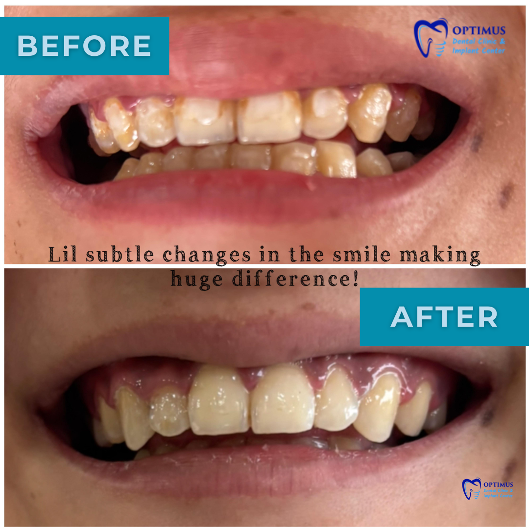 optimus_dental_clinic_Guwahati (7)
