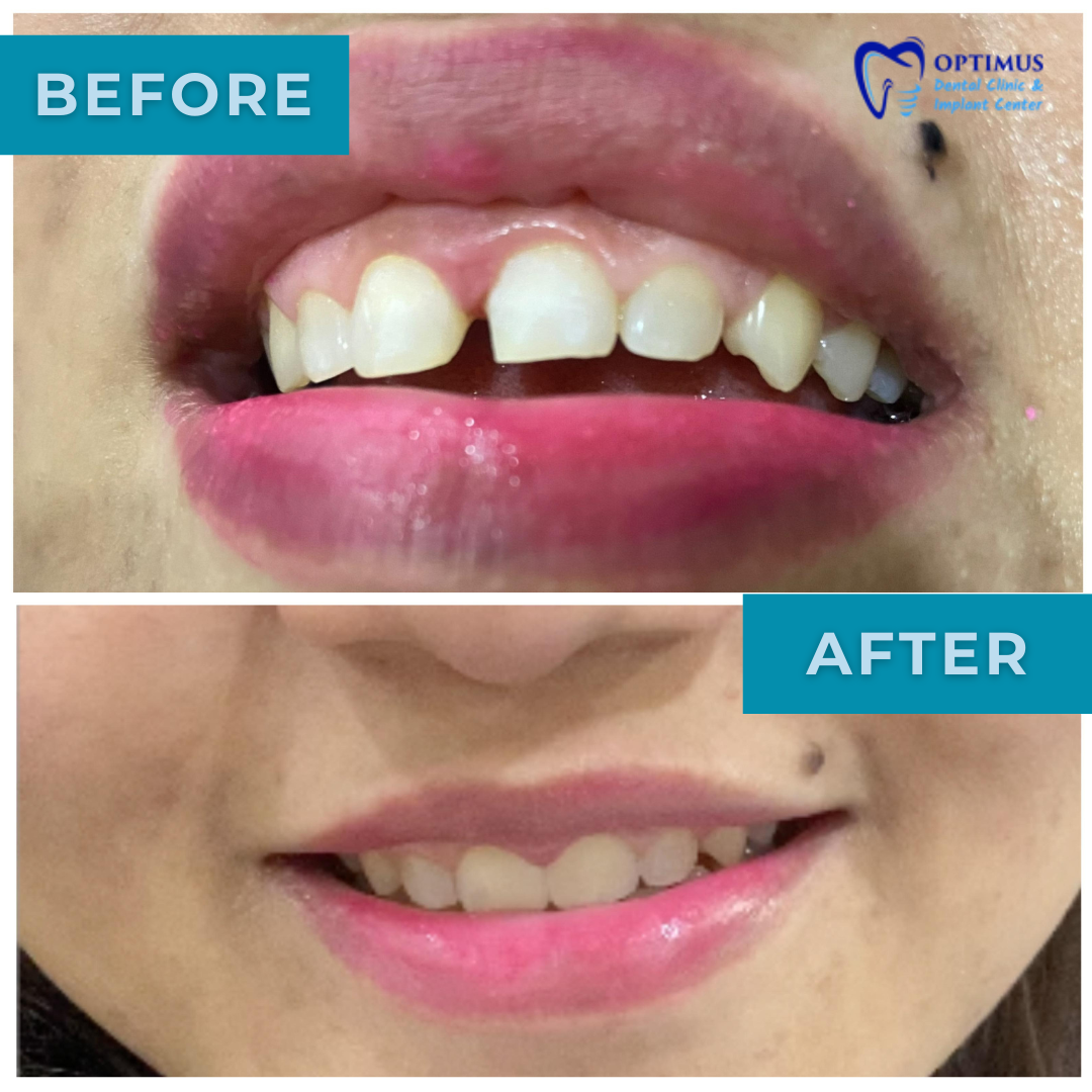 optimus_dental_clinic_Guwahati (8)