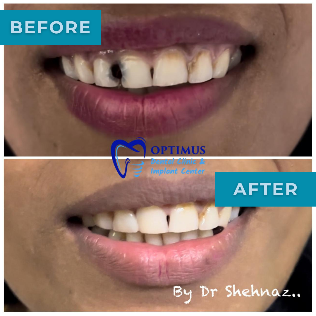 optimus_dental_clinic_Guwahati (9)