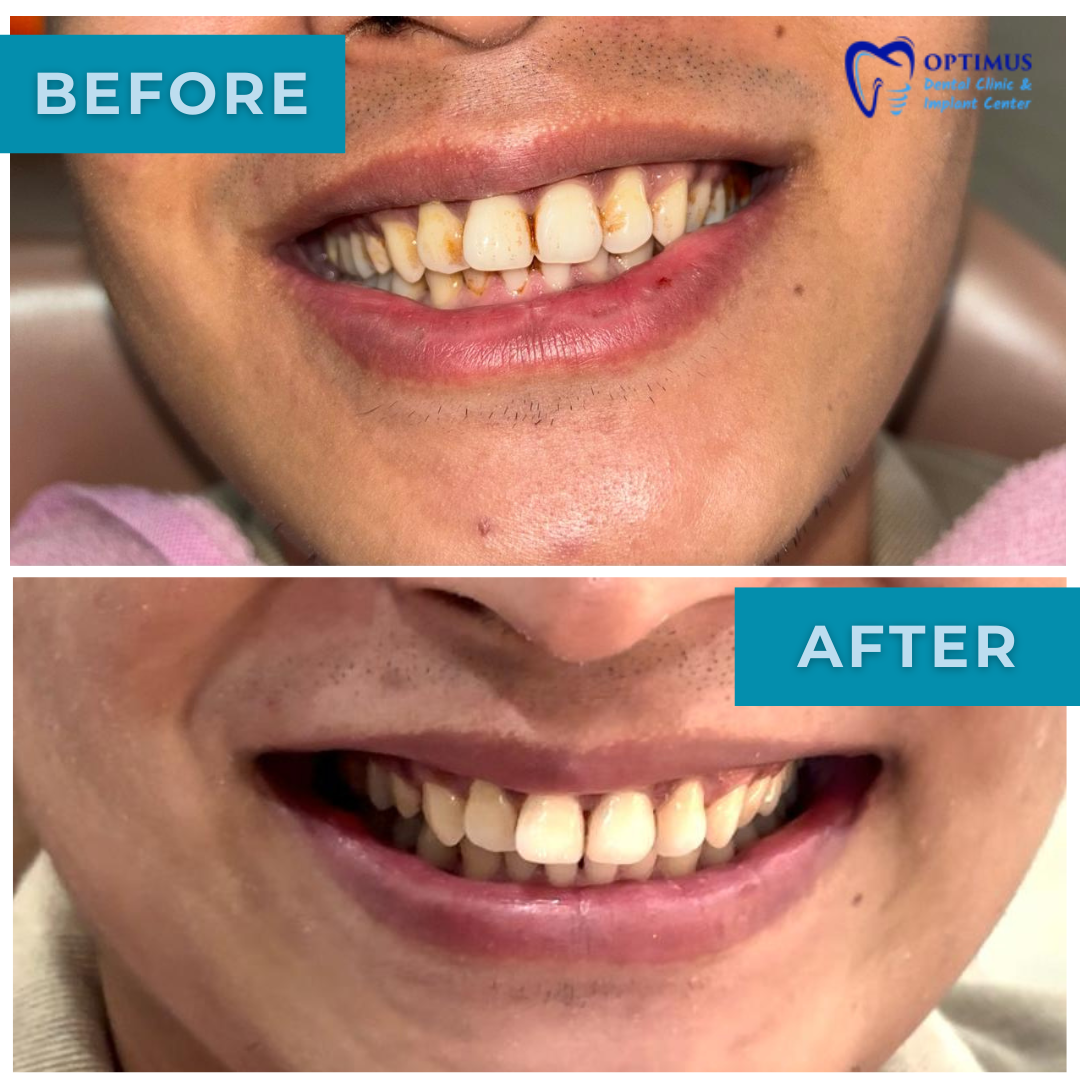 optimus_dental_clinic_Guwahati