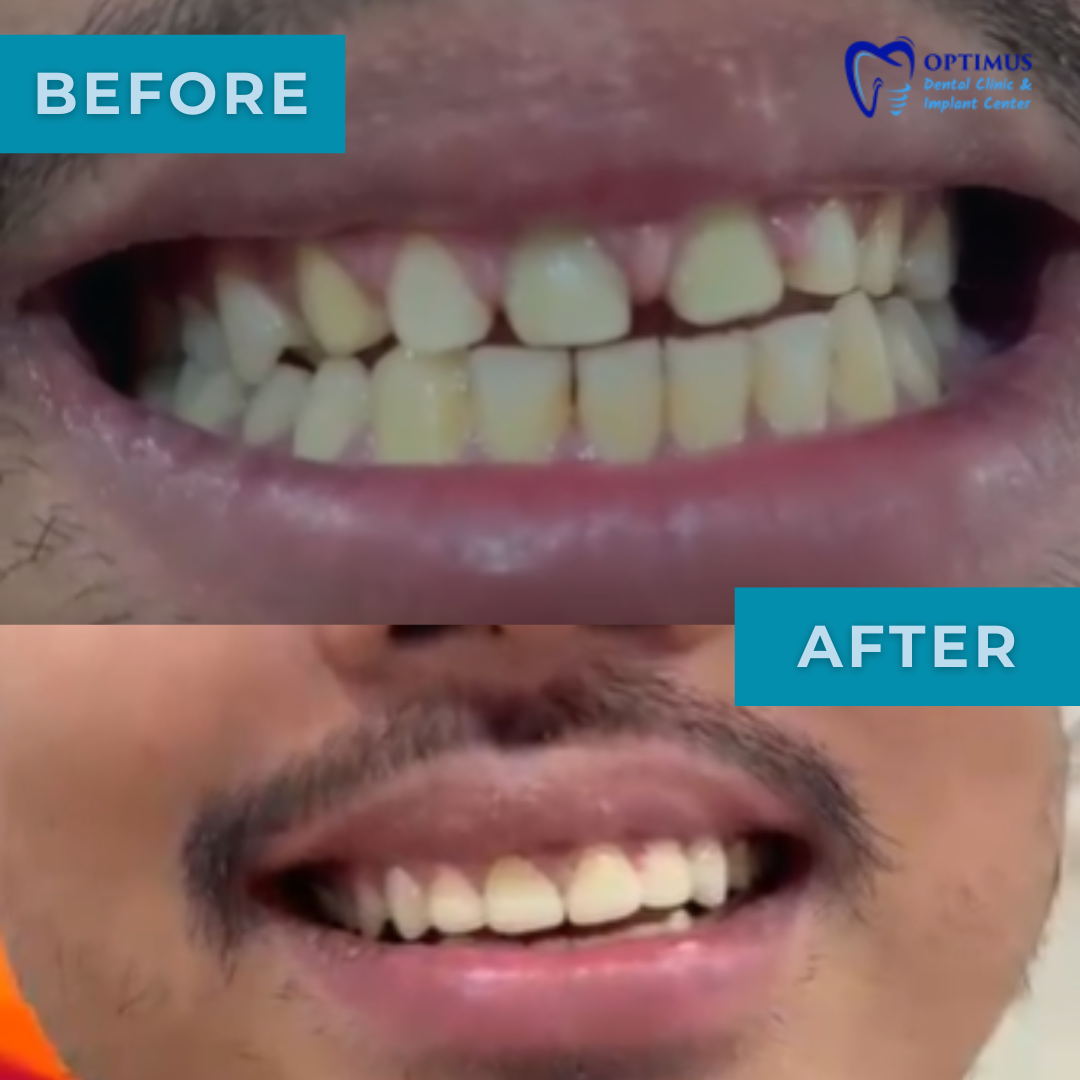 optimus_dental_clinic_Guwahati (1)