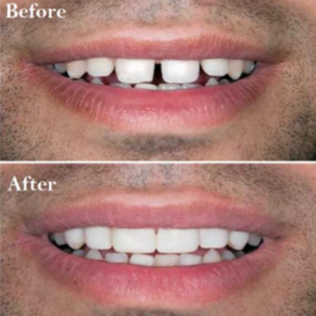 optimus_dental_clinic_Guwahati (2)