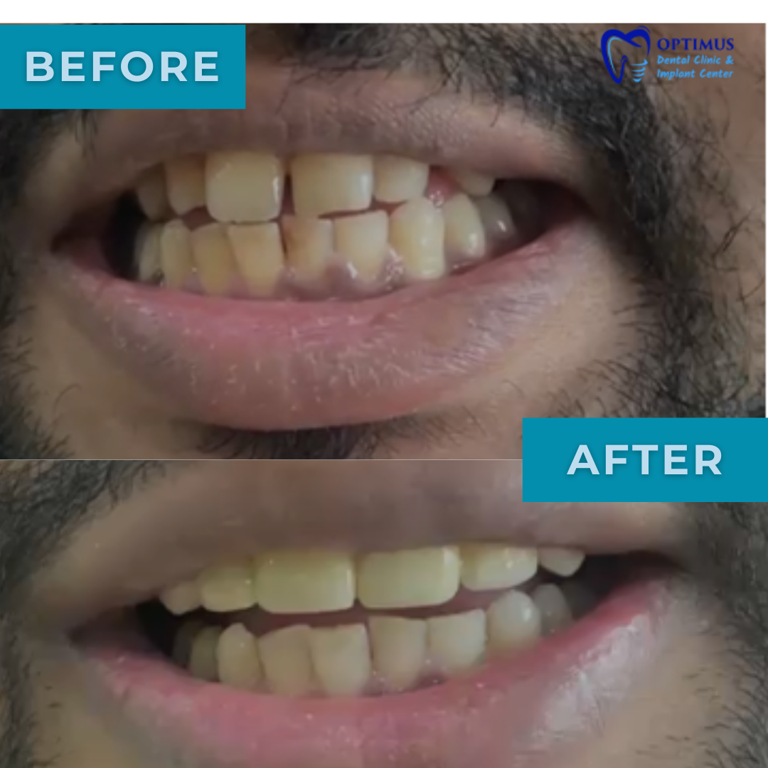 optimus_dental_clinic_Guwahati